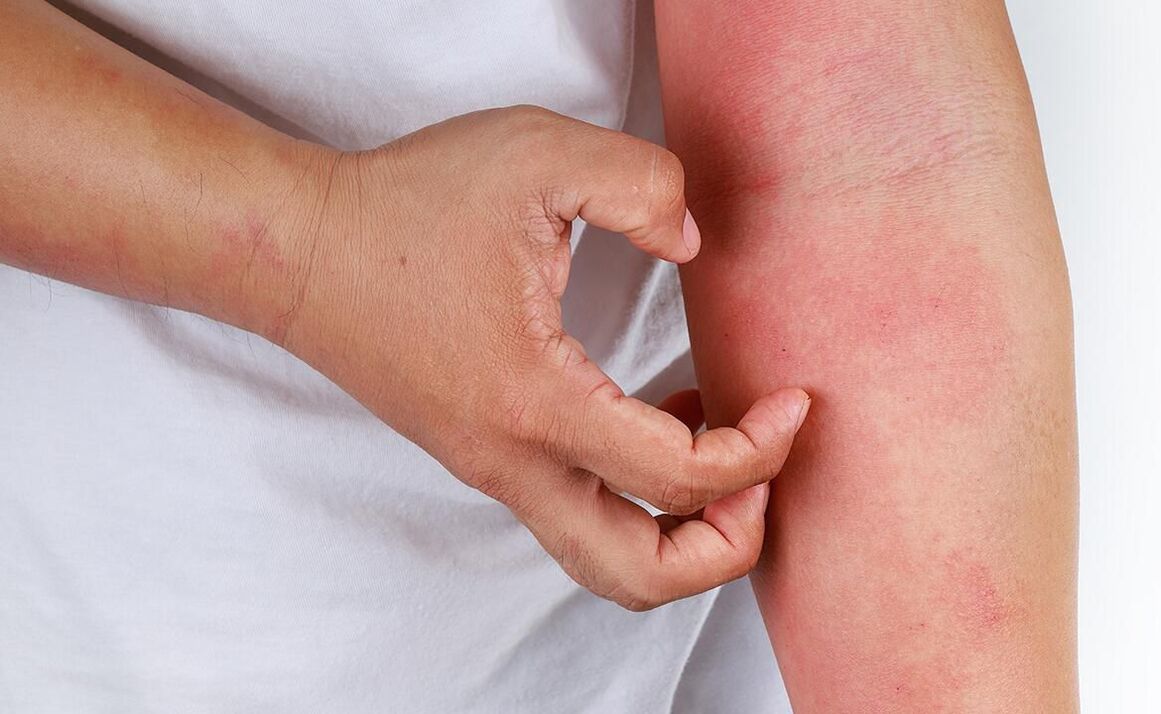 使用苏打水可能引起的并发症